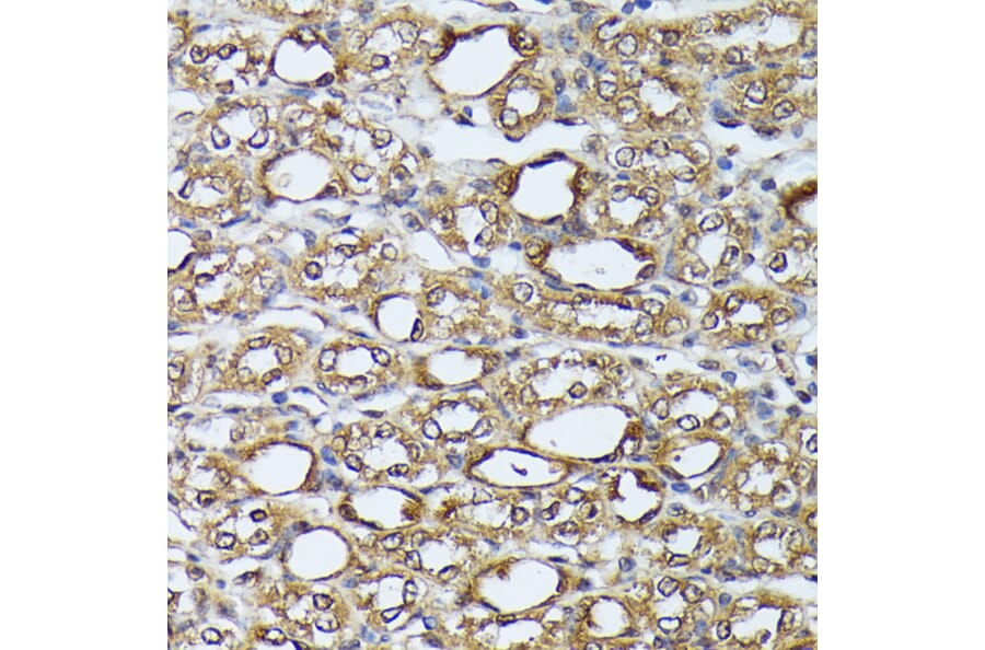 Immunohistochemistry - Anti-ZIP Kinase Antibody (A90446) - Antibodies.com