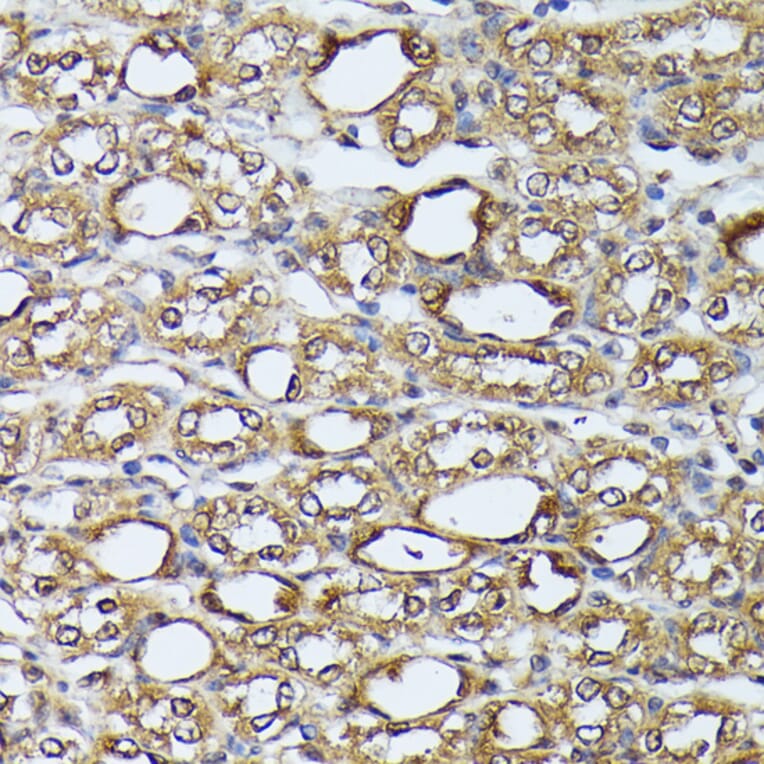 Immunohistochemistry - Anti-ZIP Kinase Antibody (A90446) - Antibodies.com