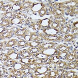 Immunohistochemistry - Anti-ZIP Kinase Antibody (A90446) - Antibodies.com