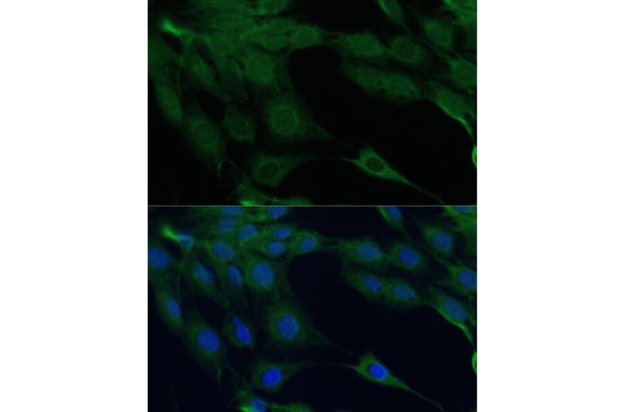 Immunofluorescence - Anti-ZIP Kinase Antibody (A90446) - Antibodies.com