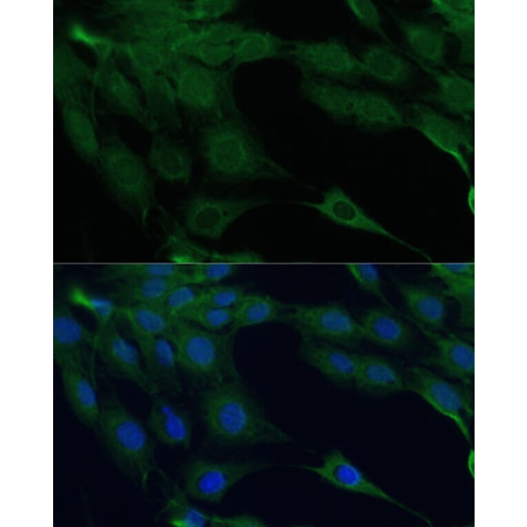 Immunofluorescence - Anti-ZIP Kinase Antibody (A90446) - Antibodies.com