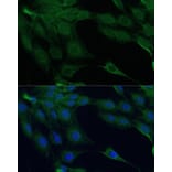 Immunofluorescence - Anti-ZIP Kinase Antibody (A90446) - Antibodies.com