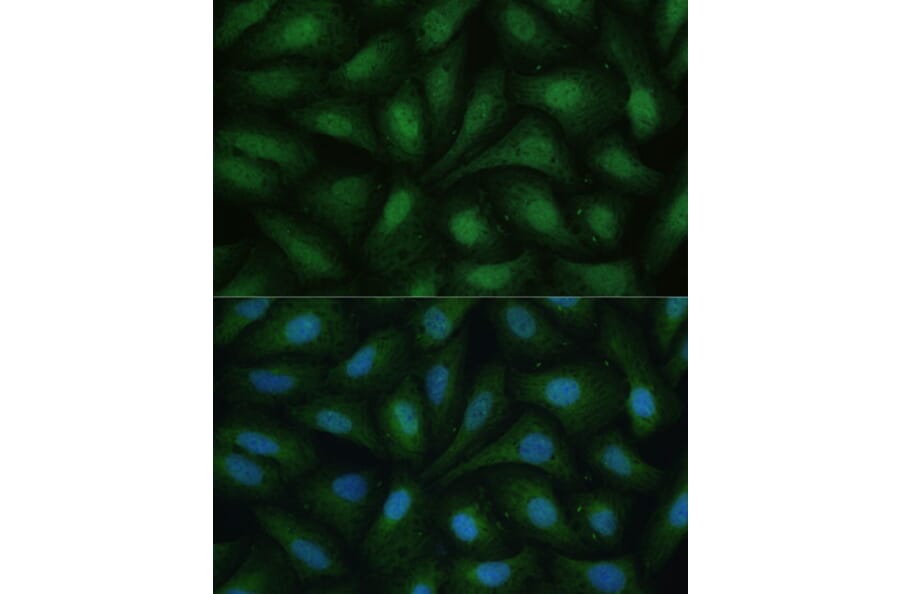 Immunofluorescence - Anti-ZIP Kinase Antibody (A90446) - Antibodies.com