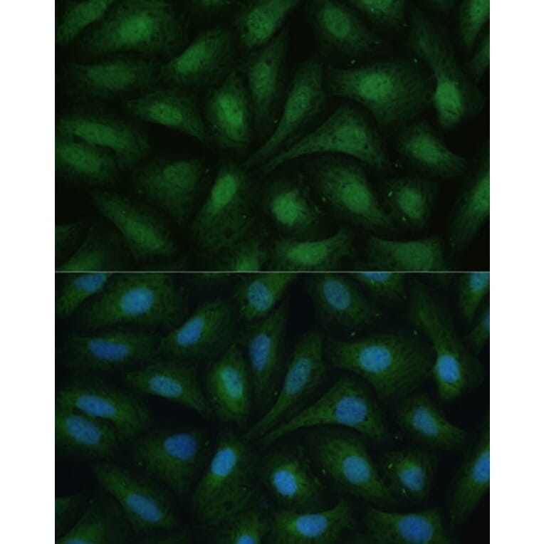 Immunofluorescence - Anti-ZIP Kinase Antibody (A90446) - Antibodies.com