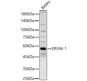 Western Blot - Anti-HERV-FRD Antibody (A90447) - Antibodies.com