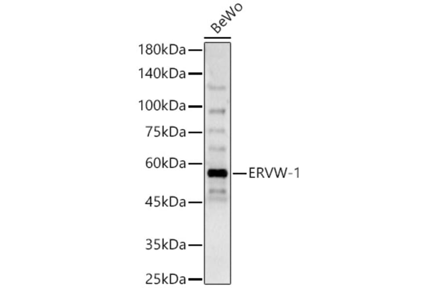 Western Blot - Anti-HERV-FRD Antibody (A90447) - Antibodies.com