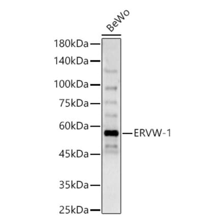 Western Blot - Anti-HERV-FRD Antibody (A90447) - Antibodies.com