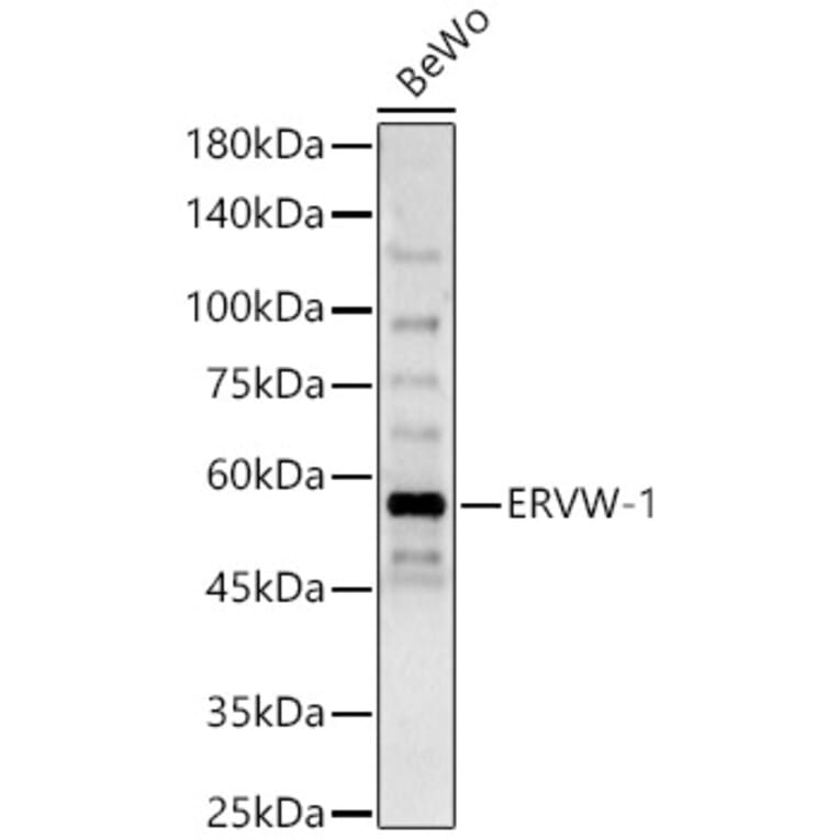 Western Blot - Anti-HERV-FRD Antibody (A90447) - Antibodies.com