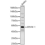 Western Blot - Anti-HERV-FRD Antibody (A90447) - Antibodies.com