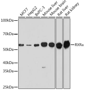 Western blot analysis of extracts of various cell lines, using Anti-RXRA Antibody (A15242) at 1:1,000 dilution.
Secondary antibody: Goat Anti-Rabbit IgG (H+L) (HRP) (AS014) at 1:10,000 dilution.
Lysates / proteins: 25µg per lane.
Blocking buffer: 3% non-fat dry milk in TBST.
Detection: ECL Basic Kit (RM00020).
Exposure time: 90s.
