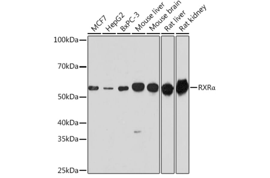 Western Blot - Anti-Retinoid X Receptor alpha/RXRA Antibody (A90448) - Antibodies.com