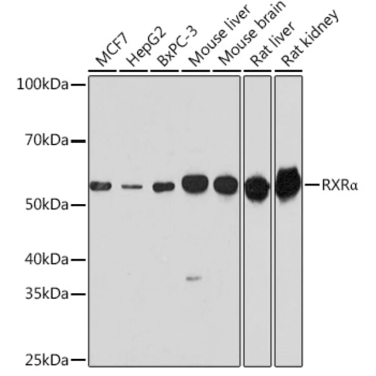 Western Blot - Anti-Retinoid X Receptor alpha/RXRA Antibody (A90448) - Antibodies.com