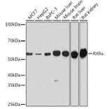 Western Blot - Anti-Retinoid X Receptor alpha/RXRA Antibody (A90448) - Antibodies.com
