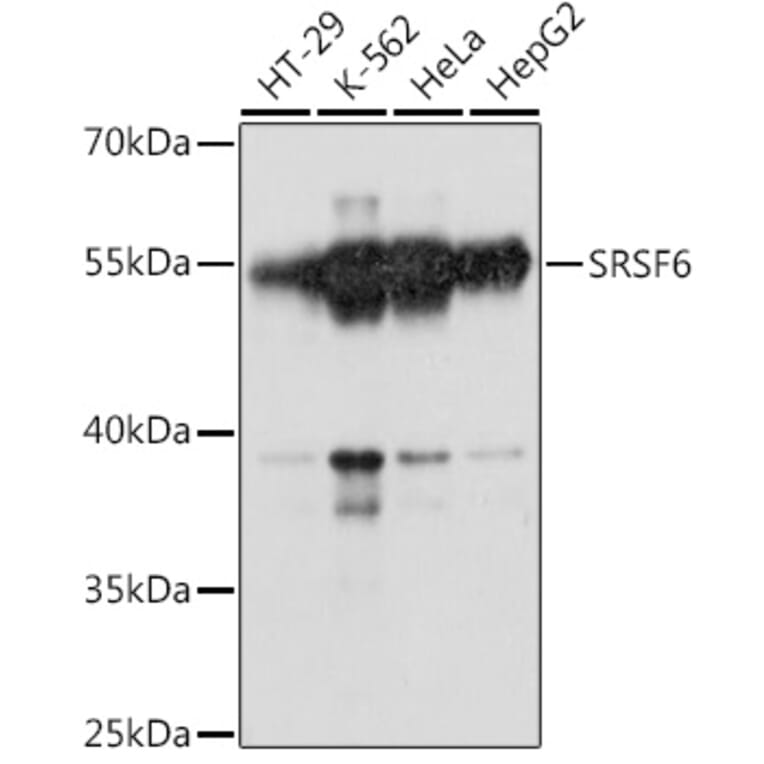 Western Blot - Anti-SR protein repeat/SRSF6 Antibody (A90449) - Antibodies.com