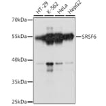 Western Blot - Anti-SR protein repeat/SRSF6 Antibody (A90449) - Antibodies.com