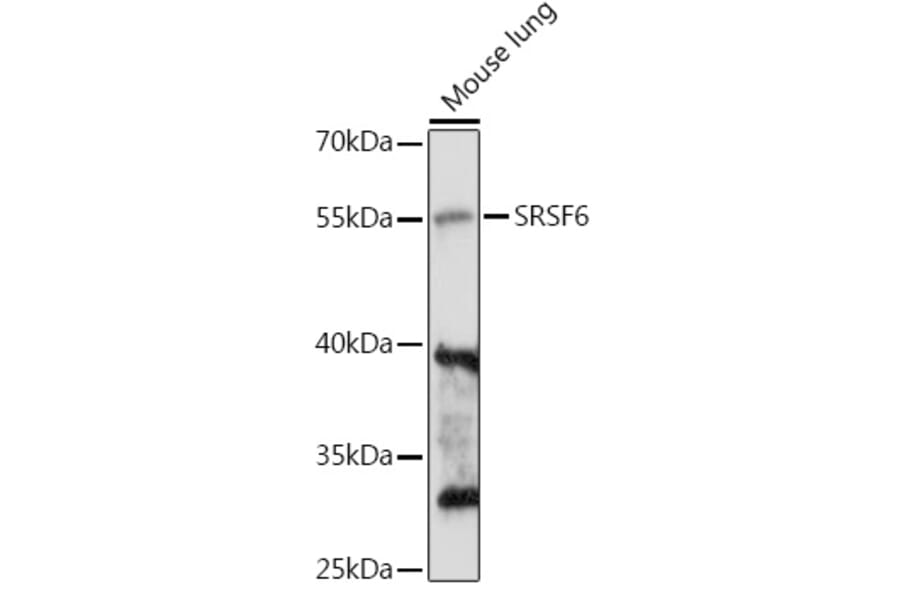 Western Blot - Anti-SR protein repeat/SRSF6 Antibody (A90449) - Antibodies.com