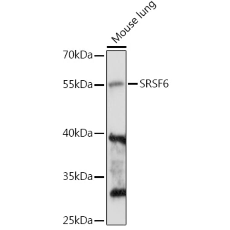 Western Blot - Anti-SR protein repeat/SRSF6 Antibody (A90449) - Antibodies.com
