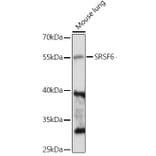 Western Blot - Anti-SR protein repeat/SRSF6 Antibody (A90449) - Antibodies.com