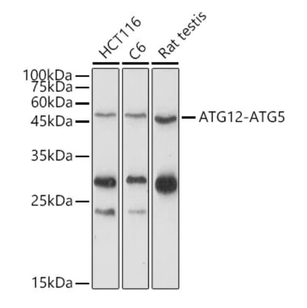Western Blot - Anti-ATG12 Antibody (A90451) - Antibodies.com