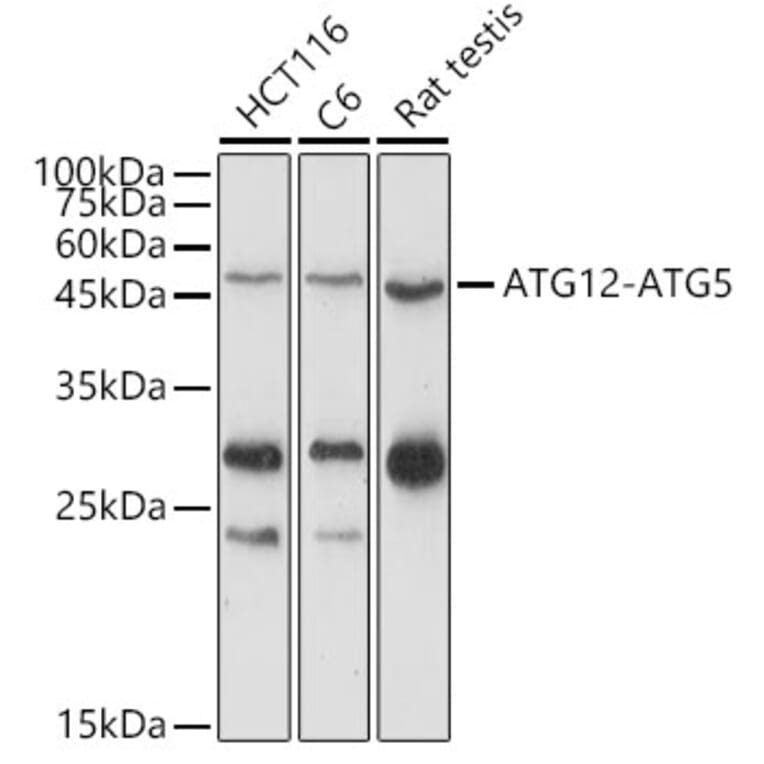 Western Blot - Anti-ATG12 Antibody (A90451) - Antibodies.com