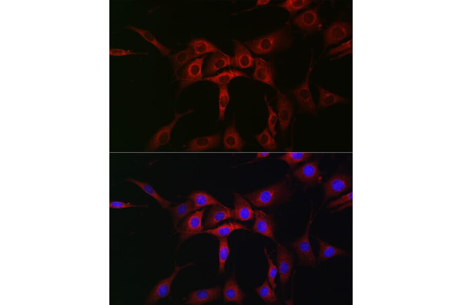 Immunofluorescence - Anti-ATG12 Antibody (A90451) - Antibodies.com