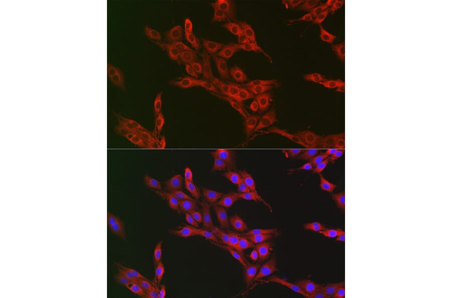 Immunofluorescence - Anti-ATG12 Antibody (A90451) - Antibodies.com