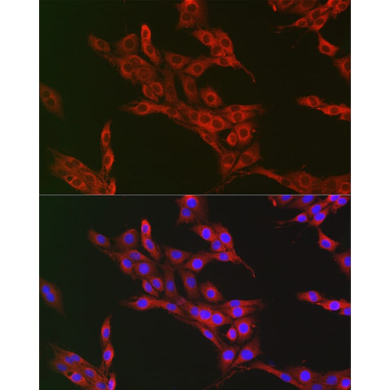 Immunofluorescence - Anti-ATG12 Antibody (A90451) - Antibodies.com