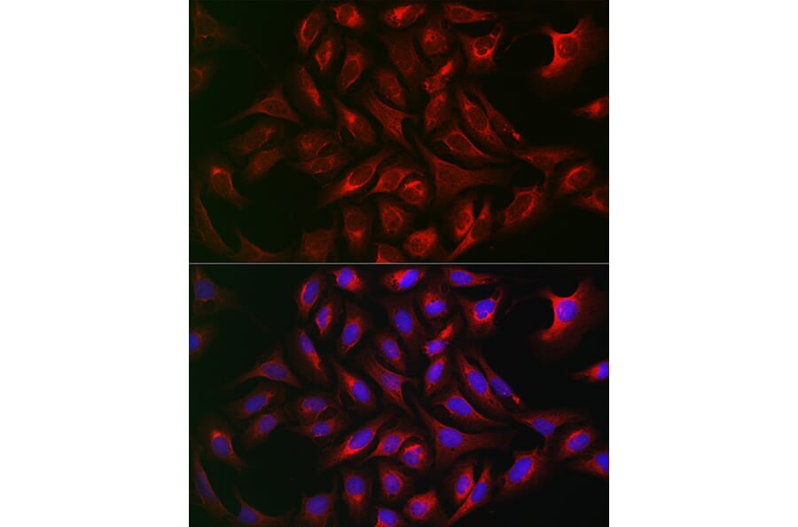 Immunofluorescence - Anti-ATG12 Antibody (A90451) - Antibodies.com