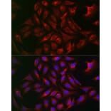 Immunofluorescence - Anti-ATG12 Antibody (A90451) - Antibodies.com