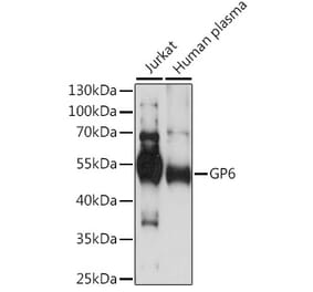 Western Blot - Anti-GPVI Antibody (A90452) - Antibodies.com