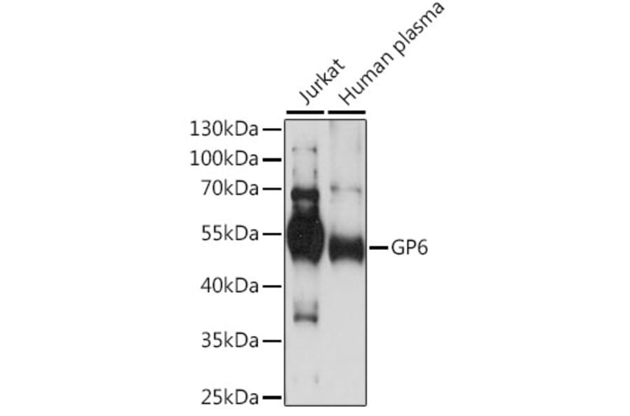 Western Blot - Anti-GPVI Antibody (A90452) - Antibodies.com