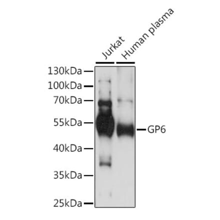 Western Blot - Anti-GPVI Antibody (A90452) - Antibodies.com