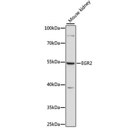 Western Blot - Anti-EGR2 Antibody (A90453) - Antibodies.com