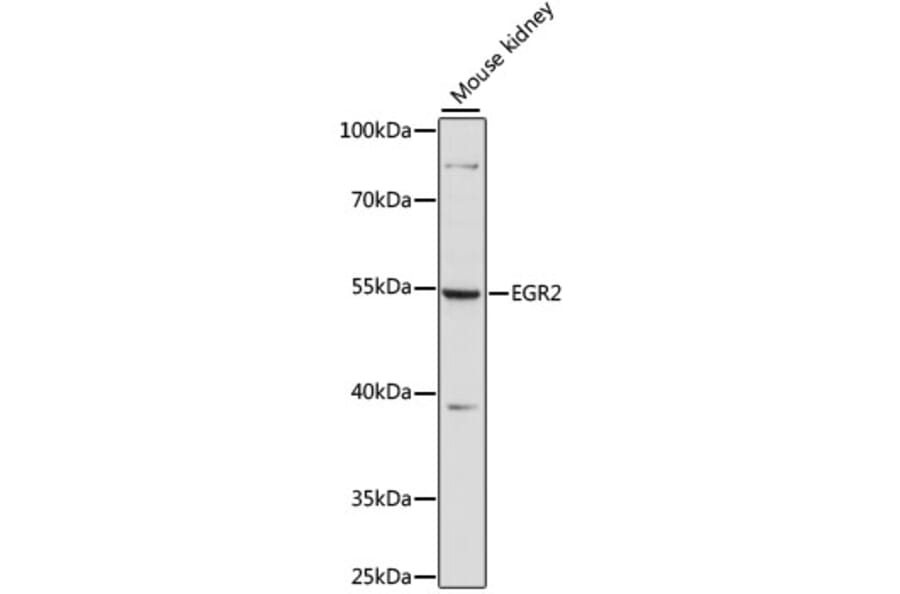 Western Blot - Anti-EGR2 Antibody (A90453) - Antibodies.com