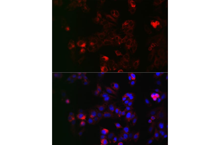 Immunofluorescence - Anti-NOX1 Antibody (A90454) - Antibodies.com