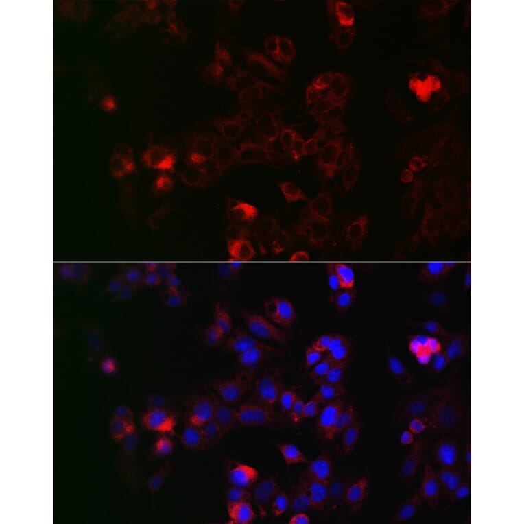 Immunofluorescence - Anti-NOX1 Antibody (A90454) - Antibodies.com