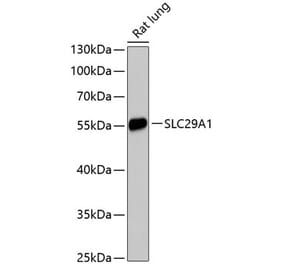 Western Blot - Anti-ENT1 Antibody (A90455) - Antibodies.com