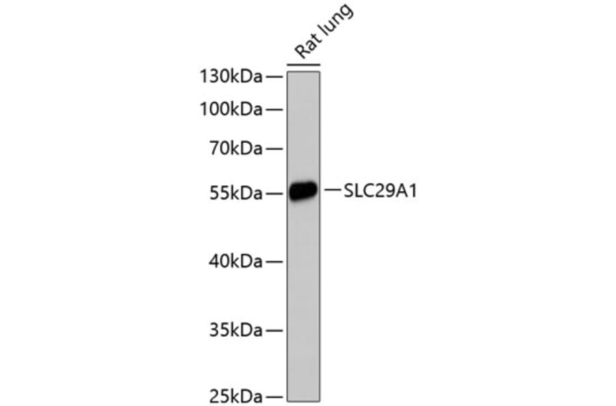 Western Blot - Anti-ENT1 Antibody (A90455) - Antibodies.com