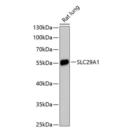 Western Blot - Anti-ENT1 Antibody (A90455) - Antibodies.com