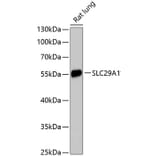 Western Blot - Anti-ENT1 Antibody (A90455) - Antibodies.com