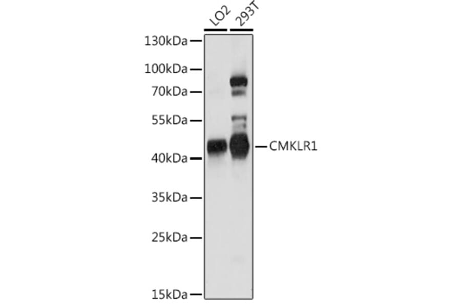Western Blot - Anti-CMKLR1 Antibody (A90457) - Antibodies.com