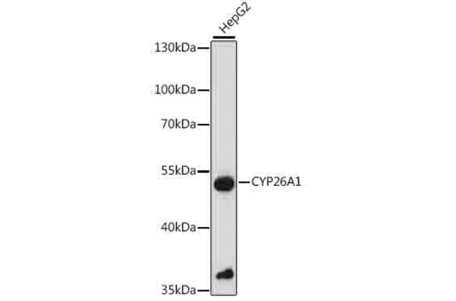 Western Blot - Anti-CYP26A1 Antibody (A90459) - Antibodies.com