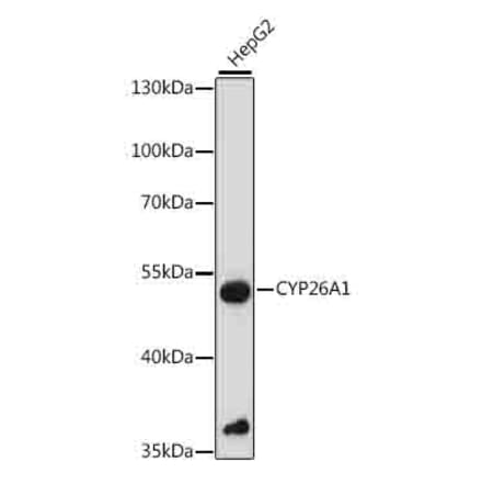 Western Blot - Anti-CYP26A1 Antibody (A90459) - Antibodies.com