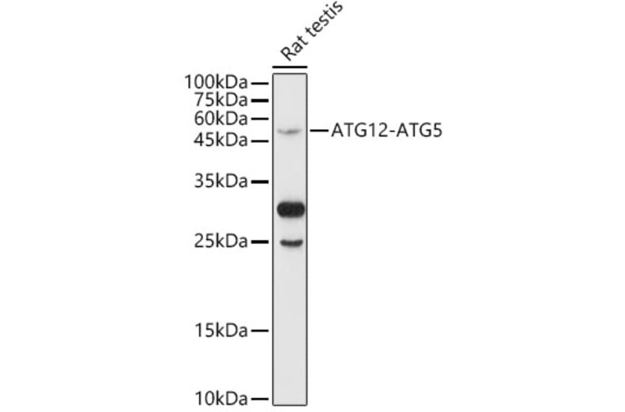Western Blot - Anti-ATG12 Antibody (A90460) - Antibodies.com
