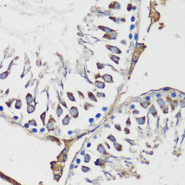 Immunohistochemistry - Anti-Cyclin B1 Antibody (A90461) - Antibodies.com