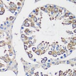 Immunohistochemistry - Anti-Cyclin B1 Antibody (A90461) - Antibodies.com