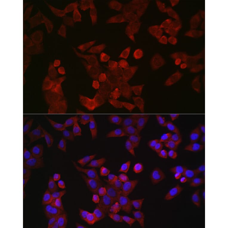 Immunofluorescence - Anti-Cyclin B1 Antibody (A90461) - Antibodies.com