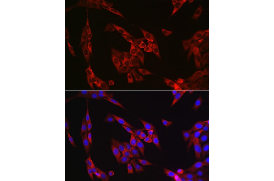 Immunofluorescence - Anti-Cyclin B1 Antibody (A90461) - Antibodies.com