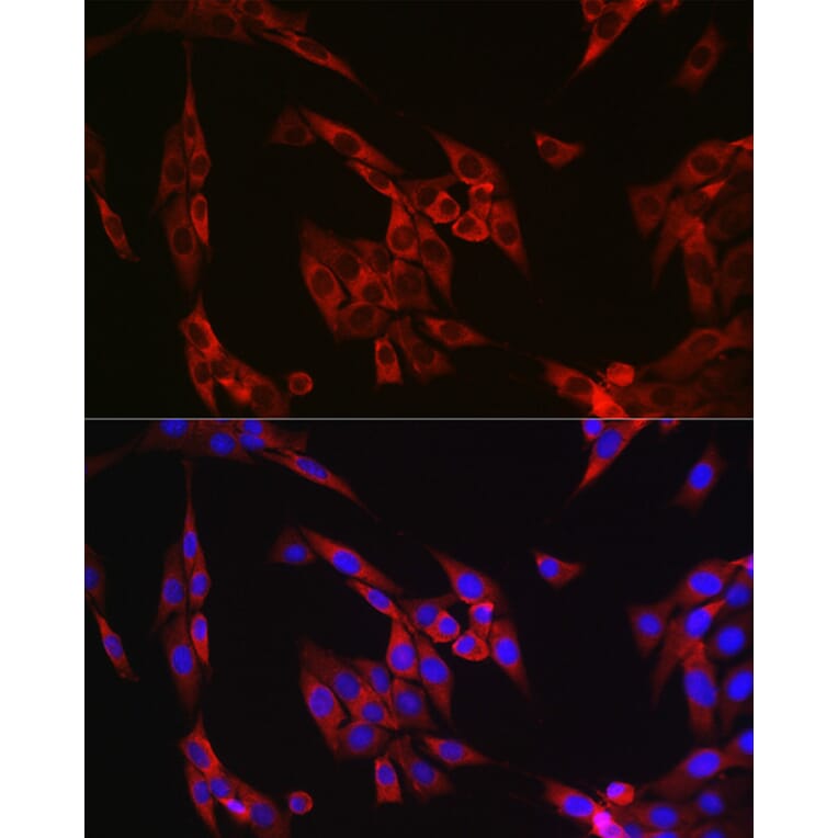 Immunofluorescence - Anti-Cyclin B1 Antibody (A90461) - Antibodies.com