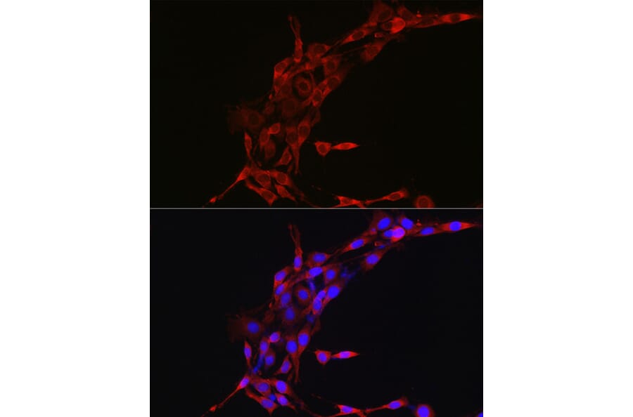 Immunofluorescence - Anti-Cyclin B1 Antibody (A90461) - Antibodies.com